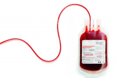 Odpowiedzialność za brak stosownej ilości krwi ponosi szpital - ciekawe rozstrzygnięcie SA w Łodzi